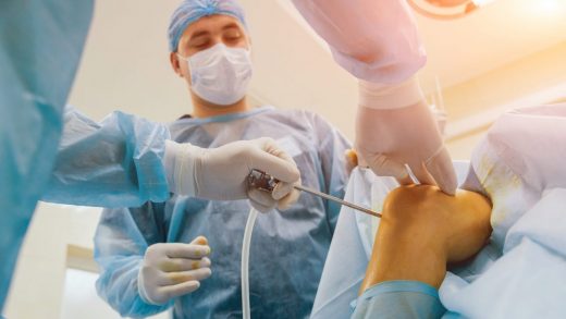 Operationsteam bei Knie-OP